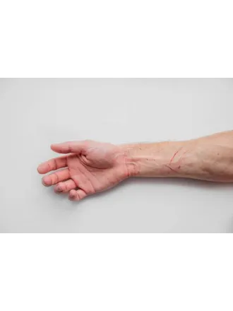 Woda utleniona na straży zdrowia